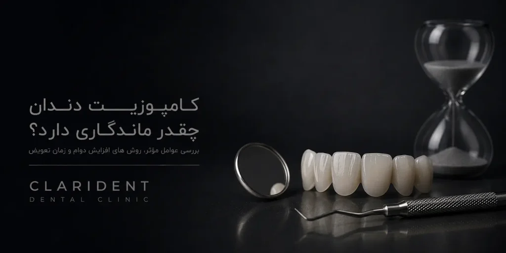 کامپوزیت دندان چقدر ماندگاری دارد