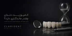 کامپوزیت دندان چقدر ماندگاری دارد? بررسی عوامل مؤثر، روش های افزایش دوام و زمان تعویض