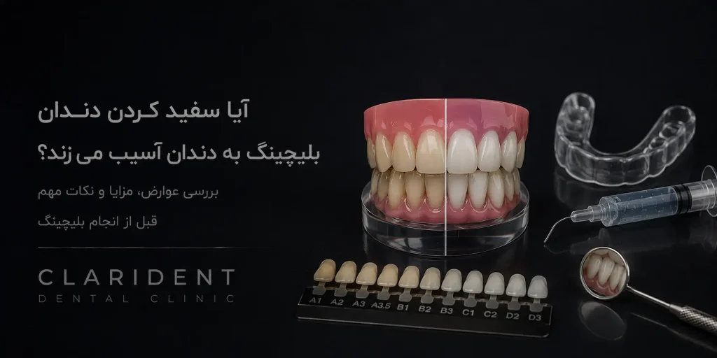 آیا سفید کردن دندان بلیچینگ به دندان آسیب می زند؟ بررسی عوارض، مزایا و نکات مهم قبل از انجام
