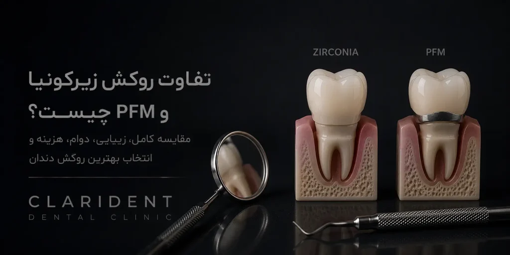 تفاوت روکش زیرکونیا و PFM چیست? مقایسه کامل زیبایی، دوام، هزینه و انتخاب بهترین روکش دندان
