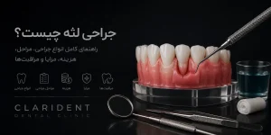 جراحی لثه چیست؟ راهنمای کامل انواع جراحی مراحل هزینه مزایا و مراقبت ها